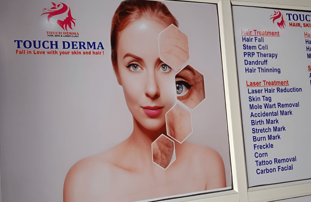 Featured Image