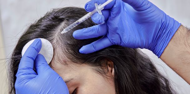 Hair Transplant in Jaipur