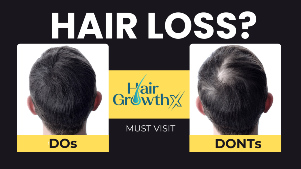 Do’s and Don’ts for Hair Loss