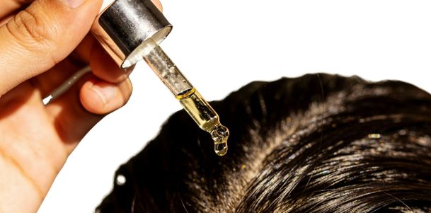 Hair Transplant in Aligarh