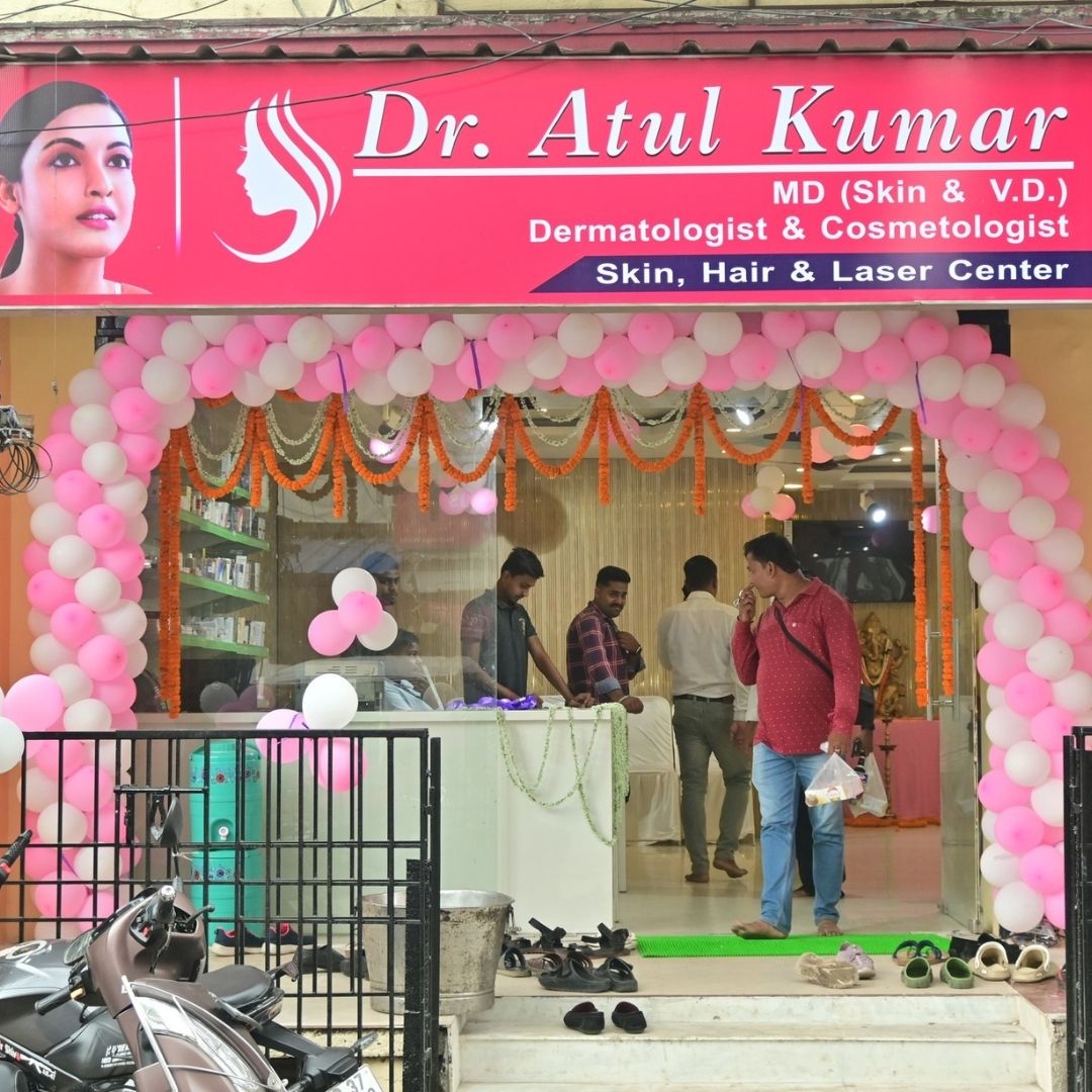Featured Image
