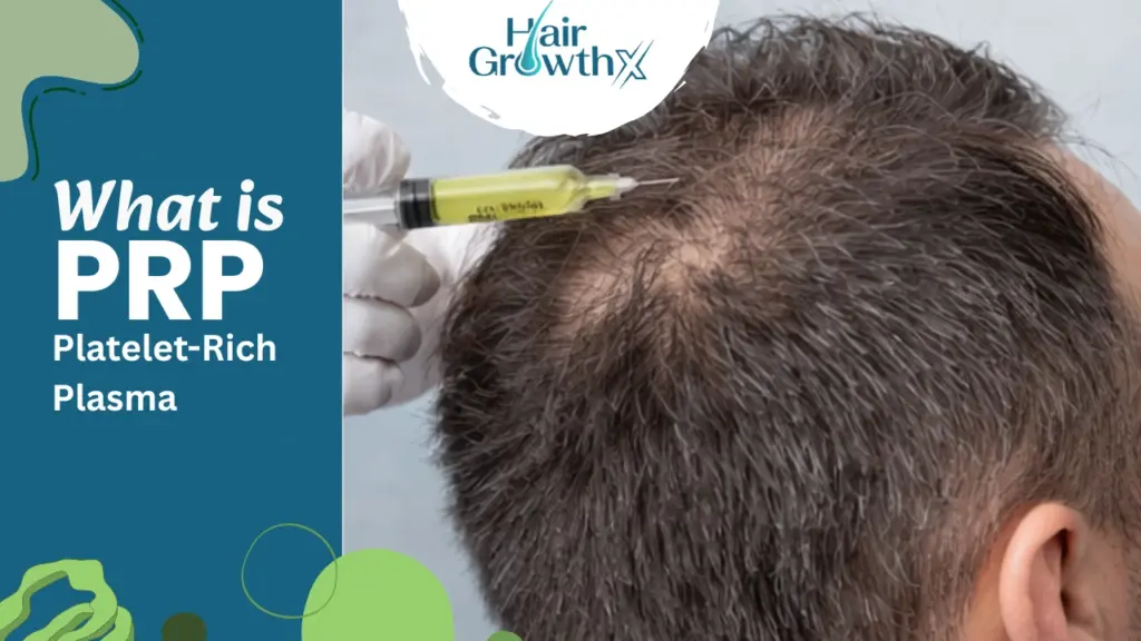 PRP Hair Treatment
