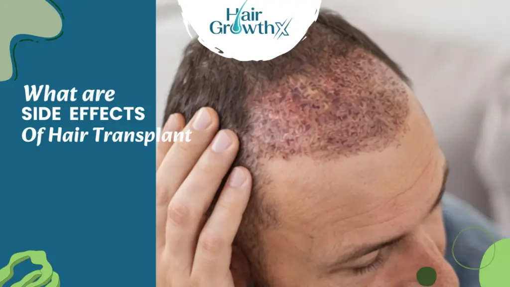 Side Effects of a Hair Transplant